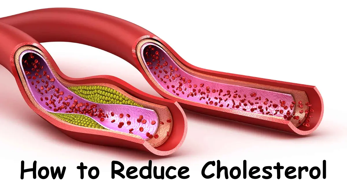 how to reduce cholesterol